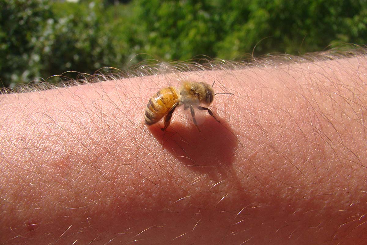 Bienen- und Wespenstiche behandeln